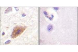 Immunohistochemistry analysis of paraffin-embedded human brain tissue, using Tyrosine Hydroxylase (Ab-8) Antibody. (Tyrosine Hydroxylase Antikörper  (AA 5-54))