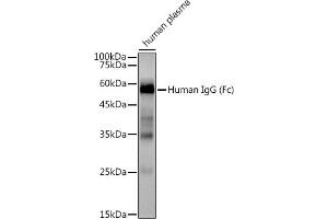 Western blot analysis of extracts of Human plasma, using Human IgG antibody (ABIN7267844) at 1:3000 dilution. (IGHG1 Antikörper)