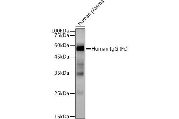 IGHG1 Antikörper