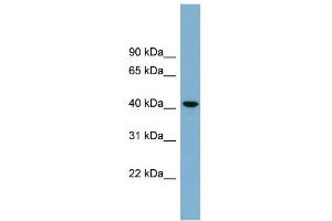 WB Suggested Anti-B4GALT2 Antibody Titration:  0. (B4GALT2 Antikörper  (Middle Region))