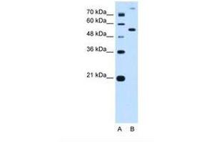 Image no. 2 for anti-Phosphoribosyl Pyrophosphate Amidotransferase (PPAT) (AA 51-100) antibody (ABIN6738207) (PPAT Antikörper  (AA 51-100))