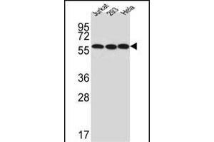 Western blot analysis of UTP6 Antibody (N-term) (ABIN651489 and ABIN2840264) in Jurkat,293,Hela cell line lysates (35 μg/lane). (UTP6 Antikörper  (N-Term))