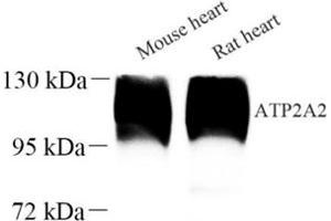 Western blot analysis of ATP2A2 (ABIN7075545) at dilution of 1: 500 (SERCA2 ATPase Antikörper)
