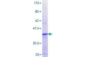 ALPK1 Protein (AA 1147-1242) (GST tag)