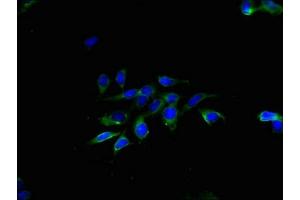 Immunofluorescent analysis of Hela cells using ABIN7173207 at dilution of 1:100 and Alexa Fluor 488-congugated AffiniPure Goat Anti-Rabbit IgG(H+L) (CNPY2/MSAP Antikörper  (AA 1-129))
