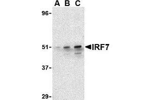 Western blot analysis of IRF7 in 293 whole cell lysate with AP30449PU-N IRF7 antibody at (A) 0. (IRF7 Antikörper  (C-Term))