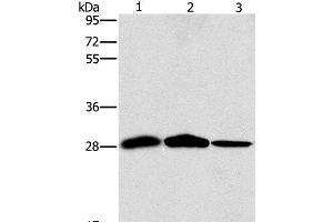 Western Blot analysis of Mouse liver and Human chromaffin cell tumor tissue, hepG2 cell using SPR Polyclonal Antibody at dilution of 1:1500 (SPR Antikörper)
