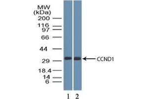 Image no. 1 for anti-Cyclin D1 (CCND1) (AA 250-300) antibody (ABIN1491282) (Cyclin D1 Antikörper  (AA 250-300))