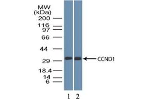 Image no. 1 for anti-Cyclin D1 (CCND1) (AA 250-300) antibody (ABIN1491282) (Cyclin D1 Antikörper  (AA 250-300))