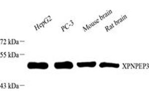 Western blot analysis of XPNPEP3 (ABIN7076237) at dilution of 1: 1000,Lane 1: HepG2 cell lysate,Lane 2: PC-3 cell lysate,Lane 3: Mouse brain tissue lysate,Lane 4: Rat brain tissue lysate