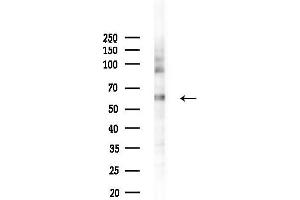 Western blot analysis of lysates from LoVo cells(heat-shock, 45 min treatment), using Phospho-Src (Tyr527)[Tyr530] Antibody at 1/1000 dilution.