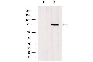 Western blot analysis of extracts from Mouse Myeloma cell, using MTA3 antibody. (MTA3 Antikörper  (Internal Region))