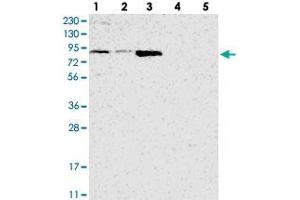 Western blot analysis of Lane 1: RT-4, Lane 2: U-251 MG, Lane 3: Human Plasma, Lane 4: Liver, Lane 5: Tonsil with ATAD2B polyclonal antibody  at 1:250-1:500 dilution. (ATAD2B Antikörper)