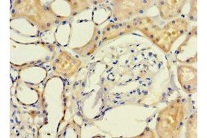 Immunohistochemistry of paraffin-embedded human kidney tissue using ABIN7158049 at dilution of 1:100 (LRCH1 Antikörper  (AA 1-105))