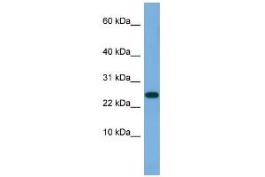 WB Suggested Anti-ANKRD39 Antibody Titration: 0. (ANKRD39 Antikörper  (N-Term))