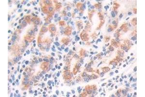 Detection of ECH1 in Human Stomach Tissue using Polyclonal Antibody to Enoyl Coenzyme A Hydratase 1, Peroxisomal (ECH1)