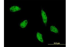 Immunofluorescence of monoclonal antibody to TFAP2B on HeLa cell. (TFAP2B Antikörper  (AA 1-449))