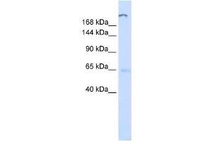 Western Blotting (WB) image for anti-ATPase, Class V, Type 10D (ATP10D) (C-Term) antibody (ABIN635469)