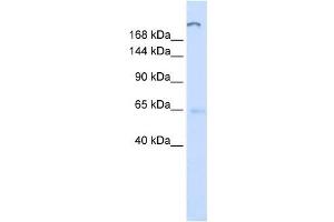 ATP10D antibody used at 1 ug/ml to detect target protein. (ATP10D Antikörper  (C-Term))