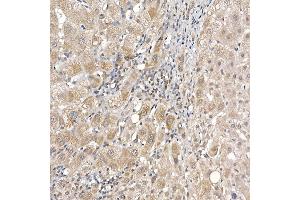 Immunohistochemistry of paraffin-embedded human liver using DC Rabbit mAb (ABIN7266685) at dilution of 1:200 (40x lens). (DCAF7 Antikörper)