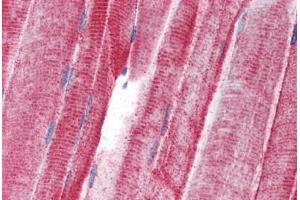 Human Skeletal Muscle (formalin-fixed, paraffin-embedded) stained with UNC93B antibody ABIN343917 at 5 ug/ml followed by biotinylated goat anti-rabbit IgG secondary antibody ABIN481713, alkaline phosphatase-streptavidin and chromogen. (UNC93B1 Antikörper  (N-Term))