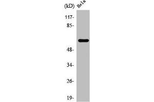 Western Blot analysis of HeLa cells using TBC1D3A/B/C Polyclonal Antibody (TBC1D3/TBC1D3B/TBC1D3C (C-Term) Antikörper)