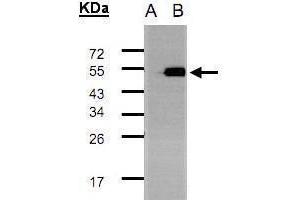 WB Image Western Blot analysis of TADA3L expression in transfected 293T cell line by TADA3L polyclonal antibody. (TADA3L Antikörper  (C-Term))