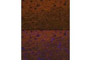 Immunofluorescence analysis of rat brain cells using Syntaxin Rabbit mAb (ABIN7270685) at dilution of 1:100 (40x lens). (Syntaxin 1B Antikörper)