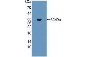Detection of Recombinant ABCC8, Human using Polyclonal Antibody to ATP Binding Cassette Transporter C8 (ABCC8) (ABCC8 Antikörper  (AA 679-929))