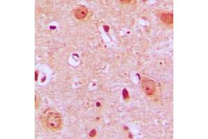 Immunohistochemical analysis of PTGR2 staining in human brain formalin fixed paraffin embedded tissue section. (PTGR2 Antikörper  (Center))
