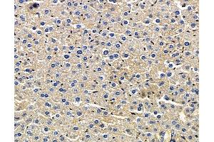 anti-GEM Interacting Protein (GMIP) antibody