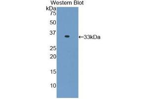 Western blot analysis of the recombinant protein. (TNNI3 Antikörper  (AA 1-211))