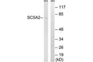 Western blot analysis of extracts from 293 cells, using SLC5A2 Antibody. (SLC5A2 Antikörper  (AA 101-150))