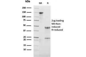 SDS-PAGE Analysis Purified OX40 Mouse Monoclonal Antibody (OX40/3108). (TNFRSF4 Antikörper  (AA 59-205))