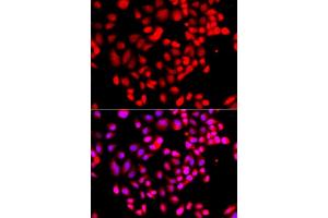 Immunofluorescence analysis of  cells using RPS6KL1 antibody (ABIN6130681, ABIN6147242, ABIN6147243 and ABIN6223376). (RPS6KL1 Antikörper  (AA 1-130))