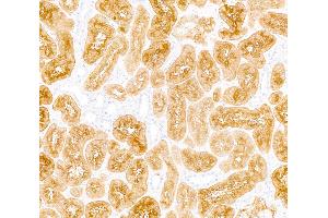 Immunohistochemistry (IHC) image for anti-Dipeptidyl-Peptidase 4 (DPP4) (AA 29-766) antibody (ABIN7795691)