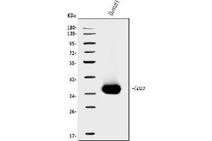 Western blot analysis of CD20/MS4A1 using anti-CD20/MS4A1 antibody (ABIN7599233). (CD20 Antikörper  (AA 1-297))