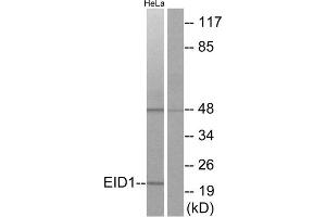 Western blot analysis of extracts from HeLa cells, using EID1 antibody. (EID1 Antikörper  (Internal Region))