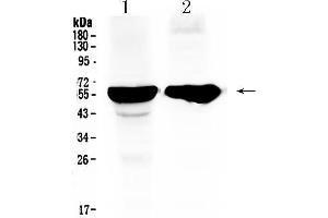 Western blot analysis of Cytochrome P450 2D6 using anti- Cytochrome P450 2D6 antibody .