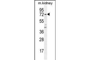 Western blot analysis in mouse kidney tissue lysates (35ug/lane). (TBXAS1 Antikörper  (AA 226-257))