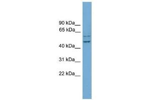 RAB11FIP2 antibody used at 1 ug/ml to detect target protein. (RAB11FIP2 Antikörper)