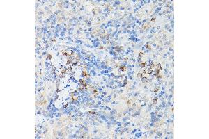 Immunohistochemistry of paraffin-embedded Mouse cartilage using Aggrecan Rabbit pAb (ABIN6127417, ABIN6136406, ABIN6136408 and ABIN6224631) at dilution of 1:50 (40x lens). (Aggrecan Antikörper  (AA 20-280))