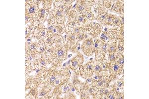 Immunohistochemistry of paraffin-embedded human liver injury using ST3GAL3 antibody. (ST3GAL3 Antikörper  (AA 30-375))