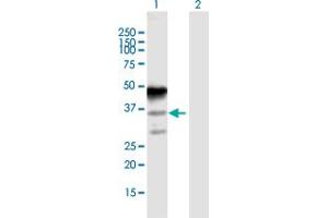 Western Blot analysis of MAGEA8 expression in transfected 293T cell line by MAGEA8 MaxPab polyclonal antibody. (MAGEA8 Antikörper  (AA 1-318))