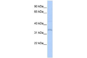 WB Suggested Anti-RNF113A Antibody Titration:  0.