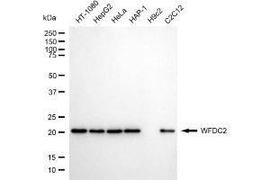 anti-WAP Four-Disulfide Core Domain 2 (WFDC2) antibody