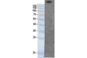 Western Blotting (WB) image for anti-CREB Binding Protein (CREBBP) (acLys1535) antibody (ABIN6281375) (CBP Antikörper  (acLys1535))
