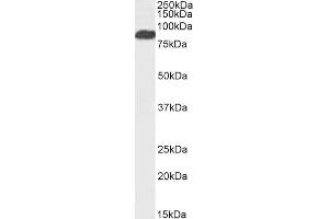 Western Blotting (WB) image for anti-Forkhead Box P2 (FOXP2) (C-Term) antibody (ABIN263146)