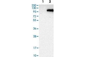 Western Blot analysis of Lane 1: negative control (vector only transfected HEK293T cell lysate) and Lane 2: over-expression lysate (co-expressed with a C-terminal myc-DDK tag in mammalian HEK293T cells) with PDE6A polyclonal antibody . (PDE6A Antikörper)