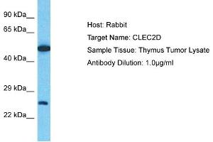 Host: Rabbit Target Name: CLEC2D Sample Type: Thymus Tumor lysates Antibody Dilution: 1. (CLEC2D Antikörper  (C-Term))